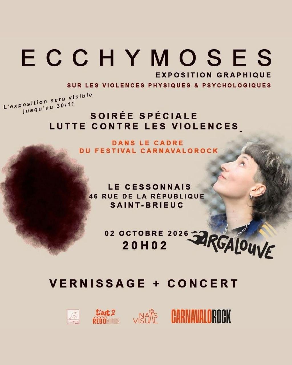 Ecchymoses